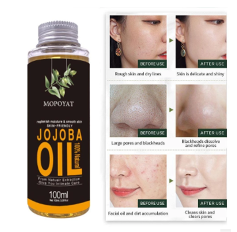 100% Pure Natural Jojoba Oil – Skin & Hair Moisturizing Oil (100ml)