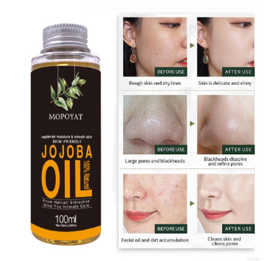 100% Pure Natural Jojoba Oil – Skin & Hair Moisturizing Oil (100ml)